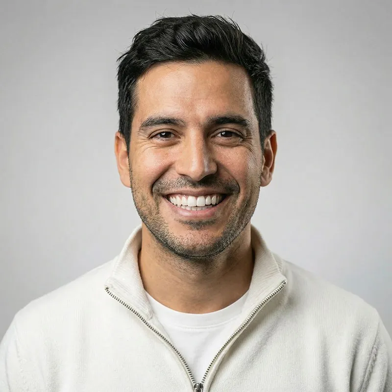 Roberto after porcelain veneers