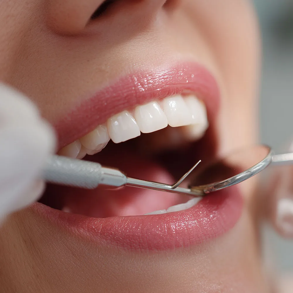 Close-up of a dental inspection