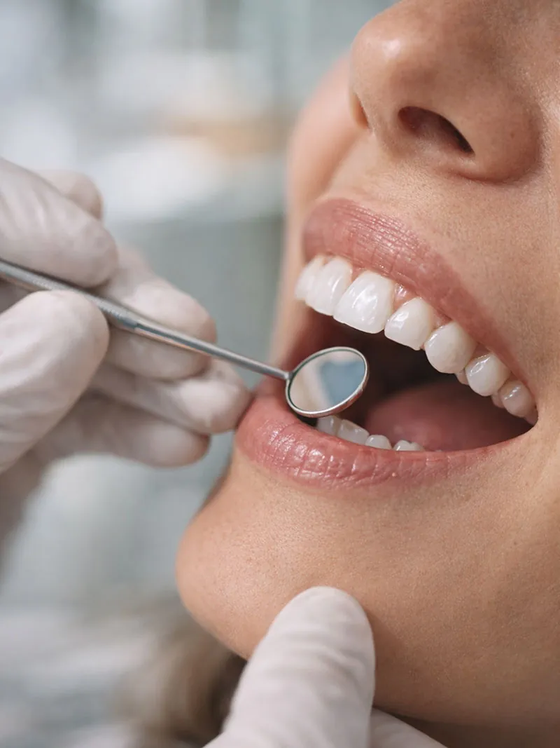 Close-up of a dentist checking a smile with a mirror
