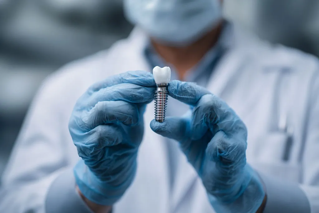A dentist holding a dental implant in a gloved hand