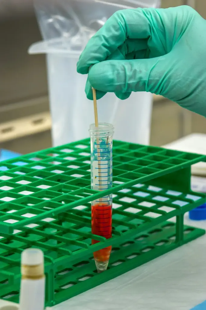 A blood sample tube in a green lab rack