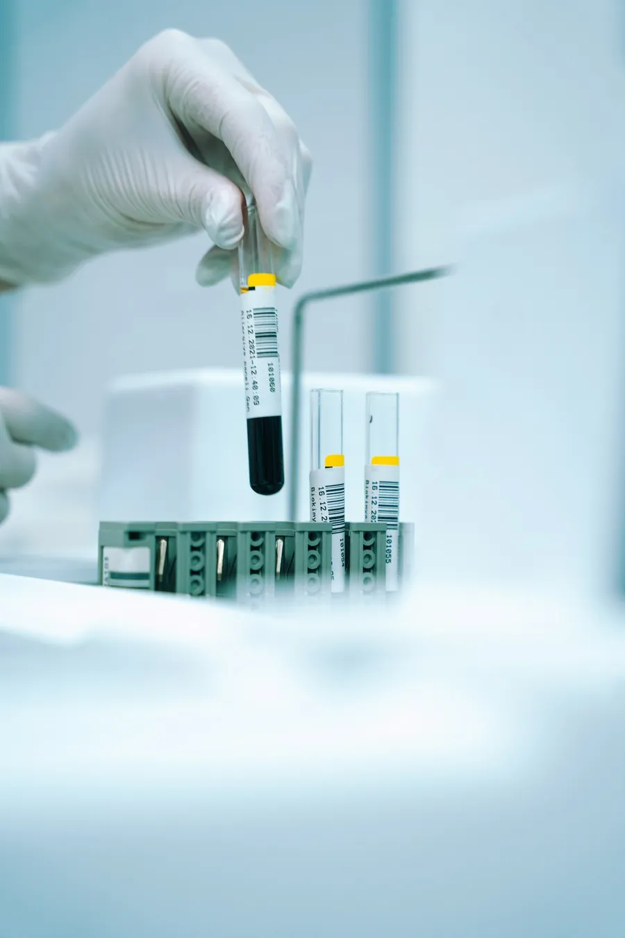 Gloved hand lifting a blood sample tube from a lab rack